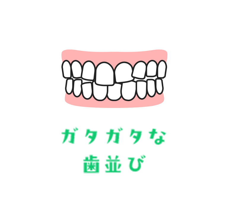 ガタガタな歯並び