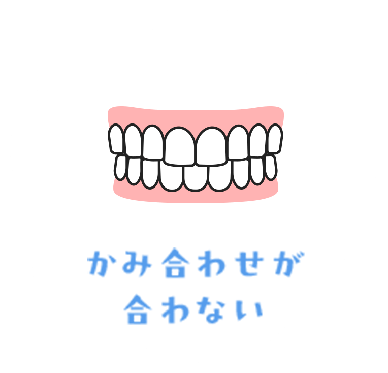 かみ合わせが合わない
